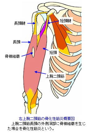 肩 上腕の打撲と挫傷