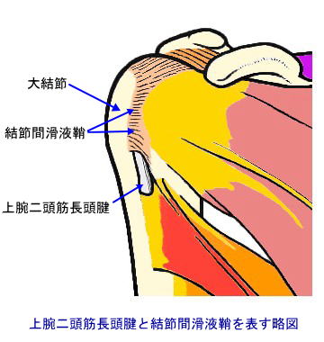 肩 上腕の打撲と挫傷