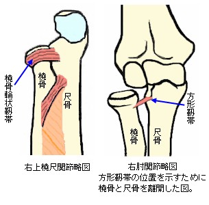 尺骨幹部骨折とモンテギア脱臼骨折