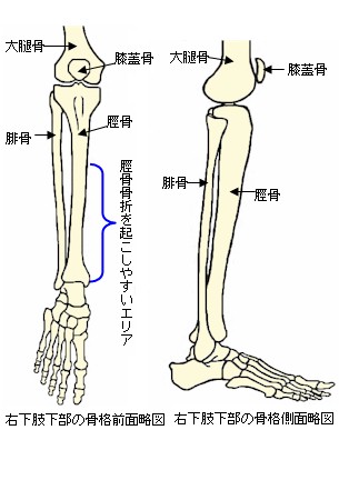 腓骨 疲労 骨折