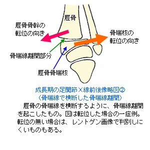 ̑֐XO㑜}Q`[JP