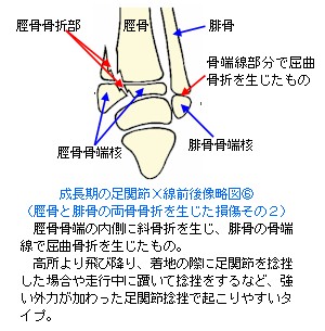 ̑֐XO㑜}U`[JT