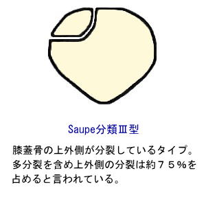 SaupeނR^