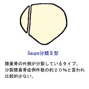 SaupeނQ^