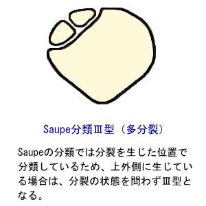 SaupeނR^`