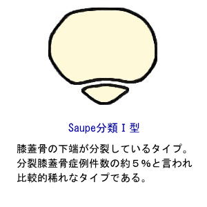 SaupeނP^