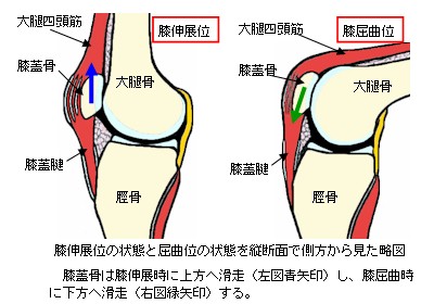 成長期のジャンパー膝