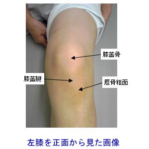 左膝正面画像