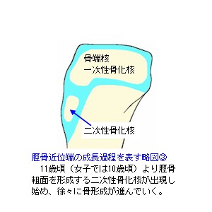 脛骨近位端成長軟骨略図３