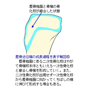 脛骨近位端成長軟骨略図５