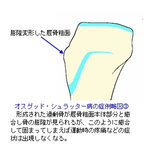 IXObhEVb^[ȁǗᗪ}R