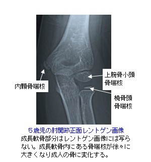 橈骨頚部骨端線離開 子どもの肘周囲の骨折