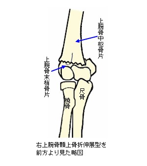 上腕骨