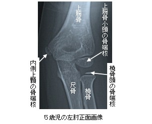 5Ύ̍IgQ摜