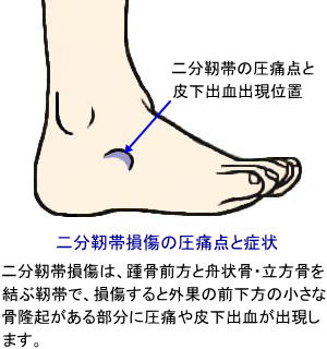 足関節の構造と足の捻挫