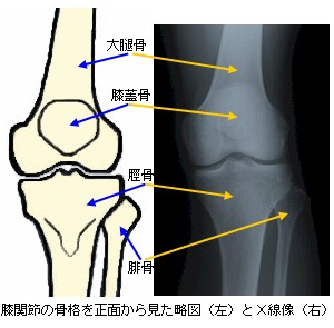 膝関節の構造と膝関節捻挫