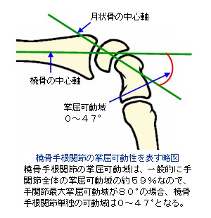 橈骨 手 根 関節