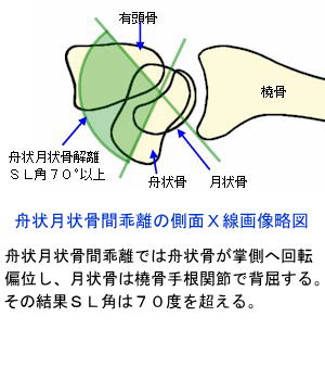 手関節の構造と手関節捻挫