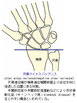 ڍ}CiXoAX